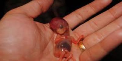 خبراء يؤكدون أن الأنفلونزا الموسمية قد تتسبب في إجهاض الحوامل 