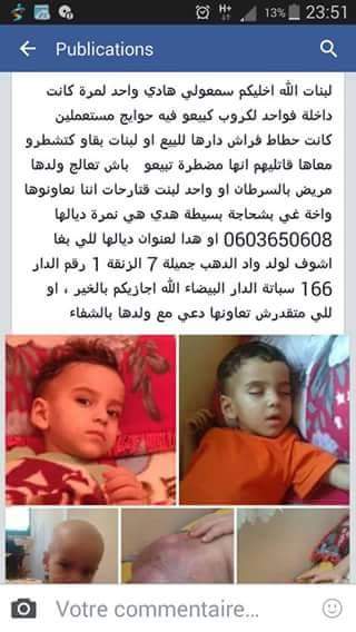 رضيع مصاب بسرطان يأكل جسده يوما عن يوم يستنجد بذوي القلوب الرحيمة