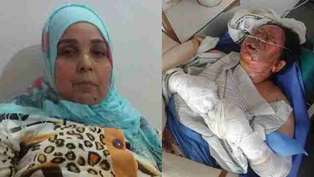 هذه تداعيات انتحار "مولات البغرير" حرقا بالقنيطرة