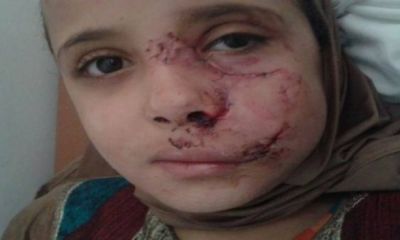 صور ... هذه الطفلة ذهبت لصلاة التراويح.. لكن ما حدث معها مؤسف!